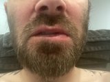 BeardedMan22