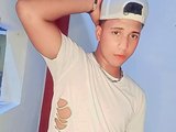 Santiago_scar