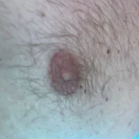 VerylittleDICK11